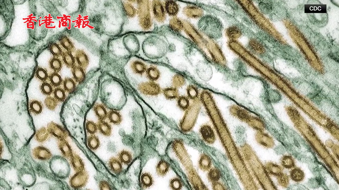 有片丨美國(guó)出現(xiàn)首例禽流感H5N1重癥病例 加州宣布進(jìn)入緊急狀態(tài)